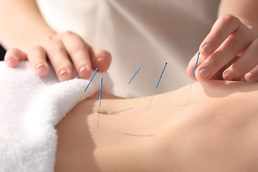 Acupuncture-980×653