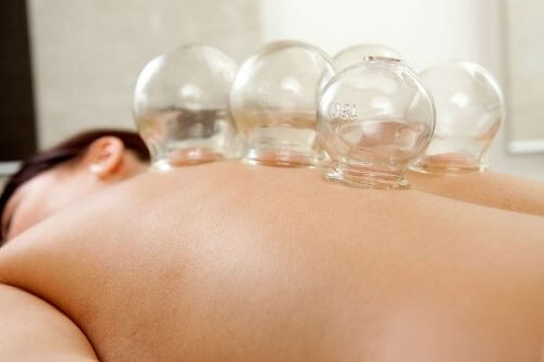 Cupping-Therapy-Background